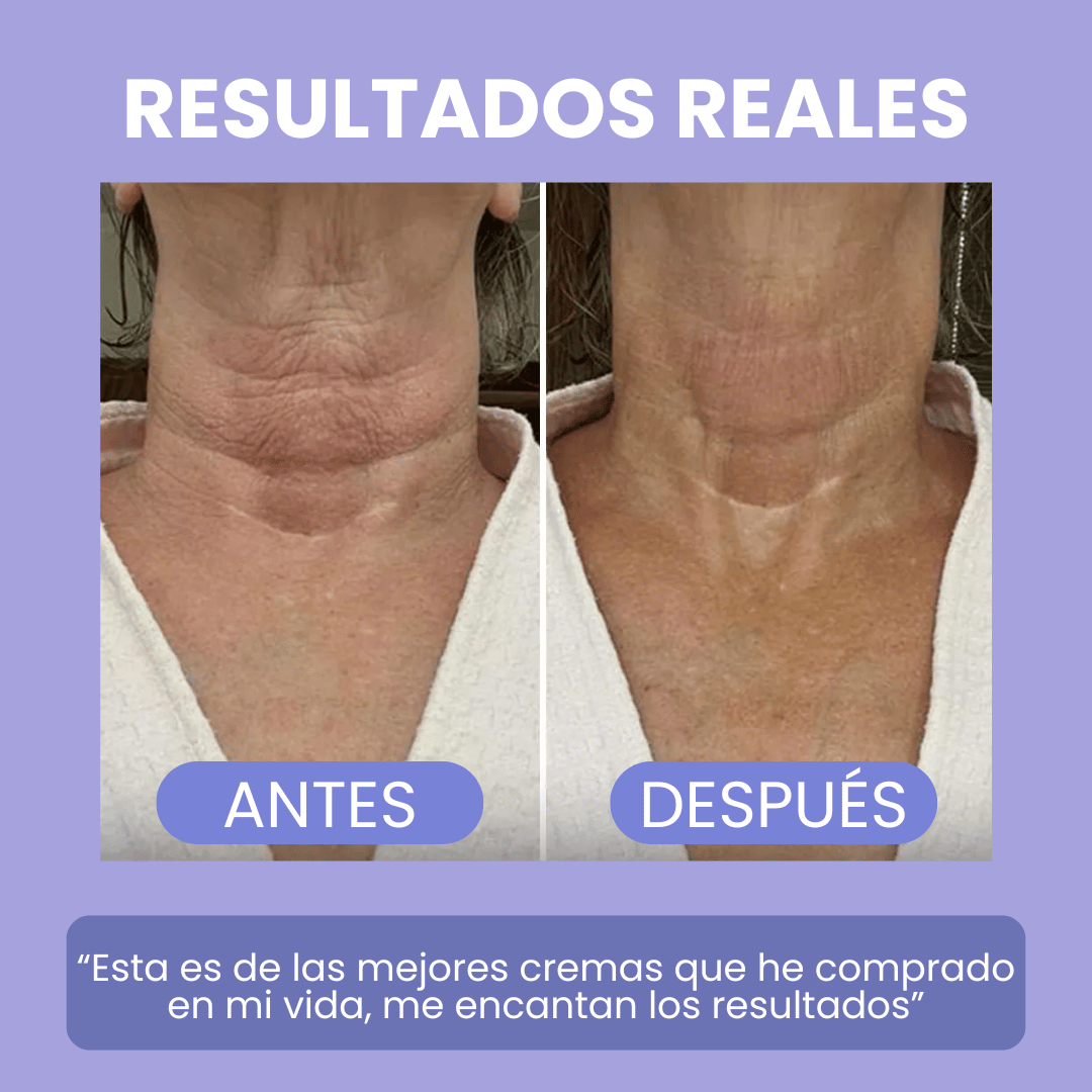 GOPURE: Reafirma tu cuello en POCO tiempo! + LIBRO DIGITAL 🎁 Y ENVÍO GRATIS 🚚