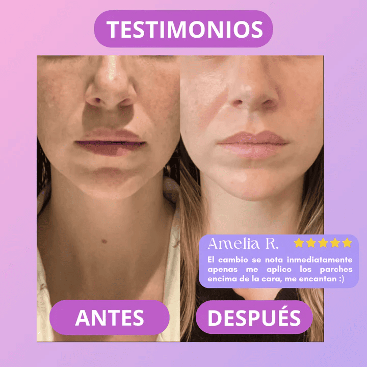 Pack Parches De Colágeno + ENVÍO GRATIS 🚚