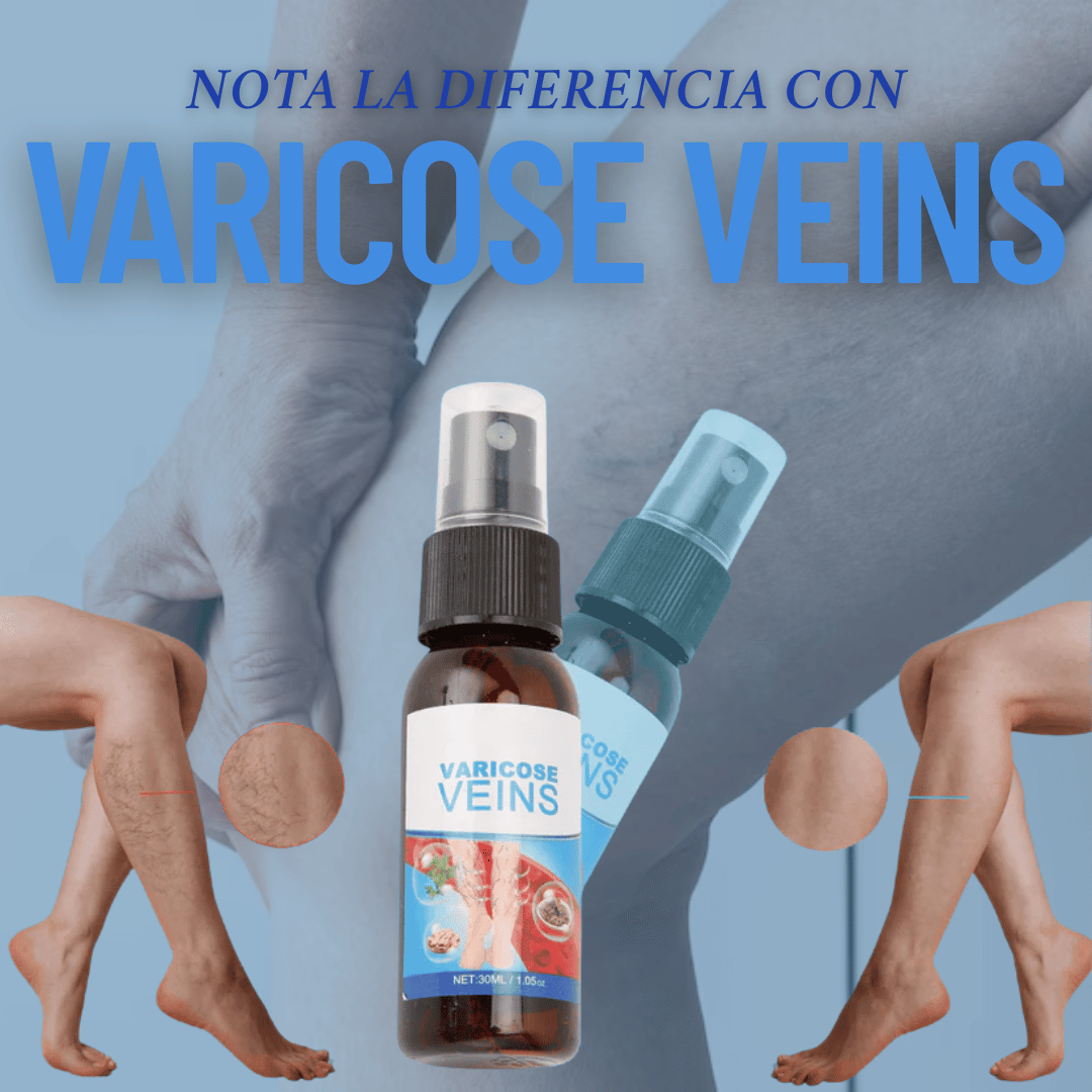 VARICOSE VEINS®: Disminuye las VARICES en POCO TIEMPO! + PARCHES DE REGALO 🎁 Y ENVÍO GRATIS 🚚