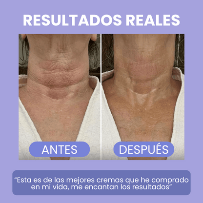 GOPURE: Reafirma tu cuello en POCO tiempo! + LIBRO DIGITAL 🎁 Y ENVÍO GRATIS 🚚