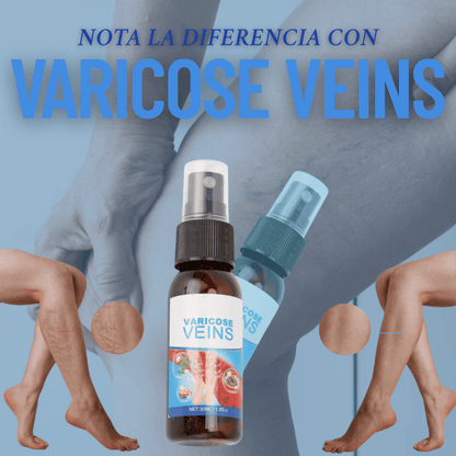 VARICOSE VEINS®: Disminuye las VARICES en POCO TIEMPO! + PARCHES DE REGALO 🎁 Y ENVÍO GRATIS 🚚